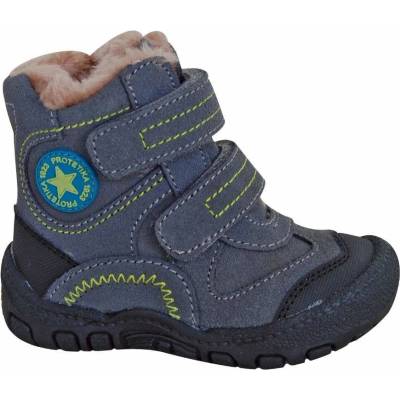 Protetika Derex šedá