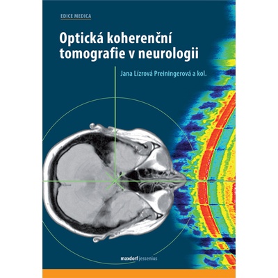 Optická koherenční tomografie v neurologii - Jana Lízrová Preiningerová