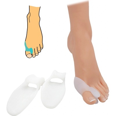 HealMed Chránič a korektor Hallux valgus 2 ks priehľadný