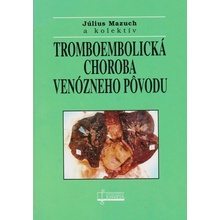 Tromboembolická choroba venózneho pôvodu - Július Mazuch a kol.