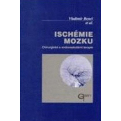 Ischémie mozku