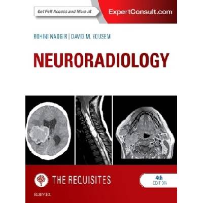 Neuroradiology: The Requisites - Nadgir Rohini