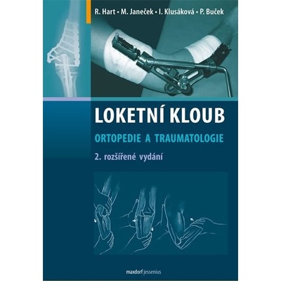 Loketní kloub