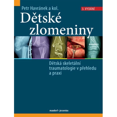 Dětské zlomeniny - Dětská skeletální traumatologie v přehledu a praxi