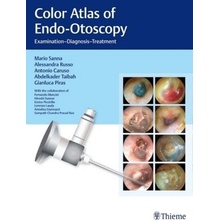 Color Atlas of Endo-Otoscopy - Sanna, Mario