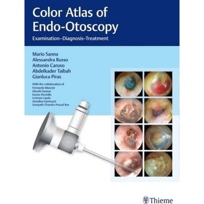 Color Atlas of Endo-Otoscopy - Sanna, Mario