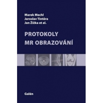 Protokoly MR zobrazování - Marek Mechl Jaroslav Tintěra Jan Žižka