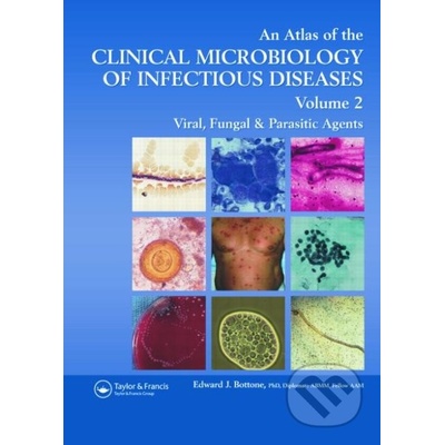 An Atlas of the Clinical Microbiology of Infectious Diseases Volume 2 - Edward J. Bottone