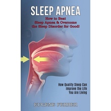 Sleep Apnea