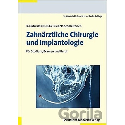 Einfhrung in die zahnrztliche Chirurgie und Implantologie Schmelzeisen RainerPevná vazba