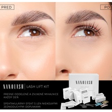 Nanolash Lash Lift Kit Nanolash Step 1 - Lift aktivátor na lifting a lamináciu mihalníc 10x0.5 ml + Nanolash Step 2 - Fix fixačný gél na lifting a lamináciu mihalníc 10x0.5 ml + Nanolash Step 3 - Kera