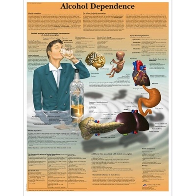Schéma - závislosť na alkohole - AJ - 50x67 cm Papier s lištou