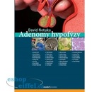 Adenomy hypofýzy