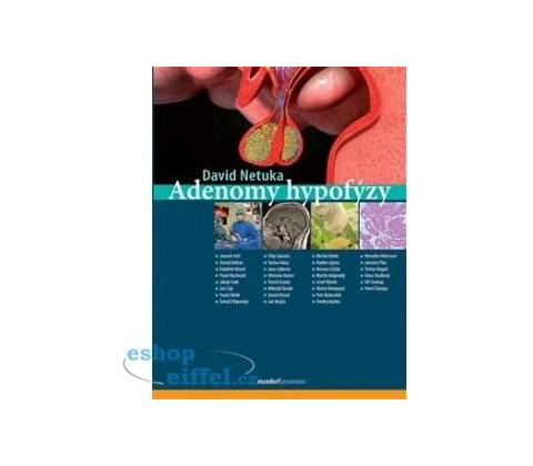 Adenomy hypofýzy