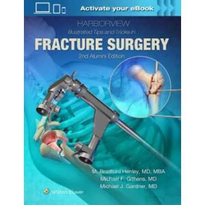 Harborview Illustrated Tips and Tricks in Fracture Surgery (2018)