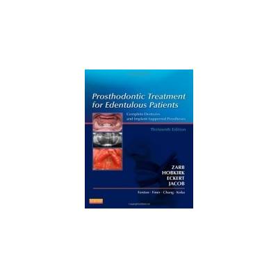 Prosthodontic Treatment for Edentulous Patients - Zarb, G. A..