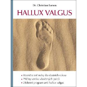 Hallux valgus | Christian Larsen (2022)