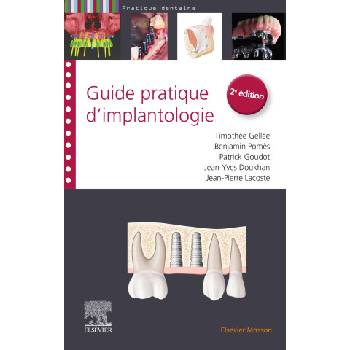 Guide pratique d'implantologie | Docteur Timothée Gellée, Benjamin Pomès, Patrick Goudot, Jean-Pierre Lacoste