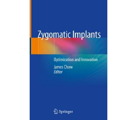 Zygomatic Implants