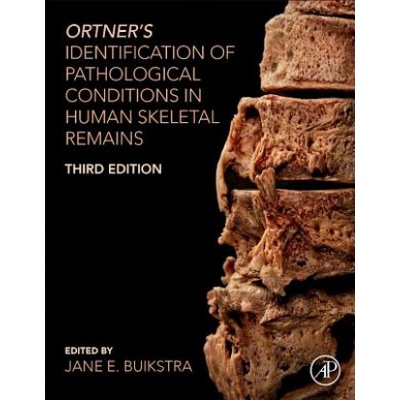 Ortner's Identification of Pathological Conditions in Human Skeletal Remains | Jane Buikstra