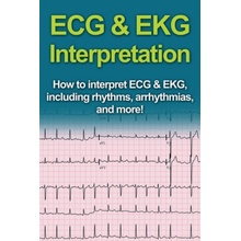 ECG & EKG Interpretation: How to interpret ECG & EKG, including rhythms, arrhythmias, and more! Pine JeremyPaperback