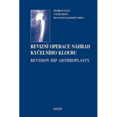 Revizní operace náhrad kyčelního kloubu - Oldřich Čech, Valér Džupa