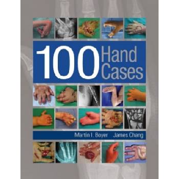 100 Hand Cases | Martin I. Boyer, James Chang