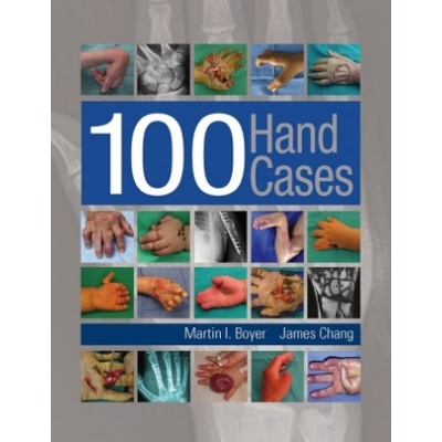 100 Hand Cases | Martin I. Boyer, James Chang