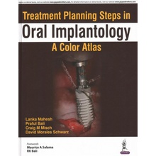 Treatment Planning Steps in Oral Implantology