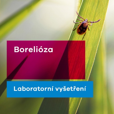 EUC Laboratoře test na boreliózu