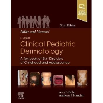 Paller and Mancini - Hurwitz Clinical Pediatric Dermatology