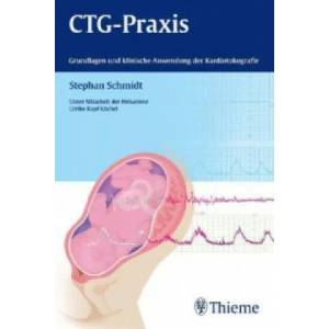 CTG-Praxis | Stephan Schmidt, Ulrike Kopf-Löchel (ISBN: 9783131699619)