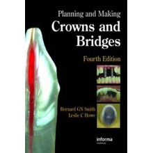 Planning and Making Crowns and Bridges