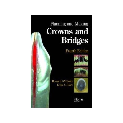 Planning and Making Crowns and Bridges