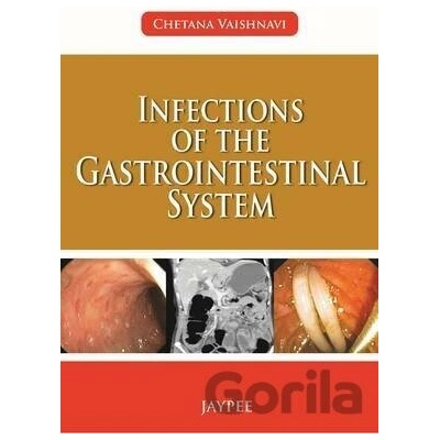 Infections of the Gastrointestinal System - Chetana Vaishnavi