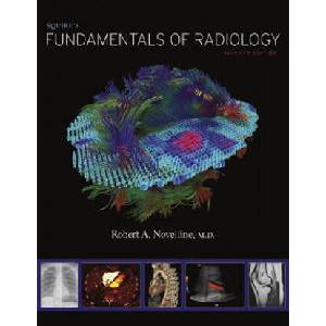 Squire's Fundamentals of Radiology | Robert A. Novelline (ISBN: 9780674057951)
