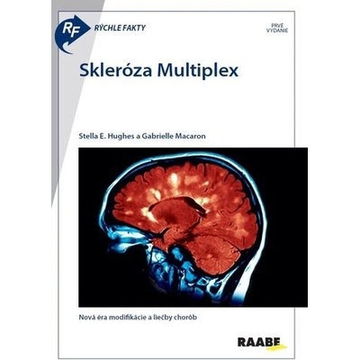Skleróza Multiplex - Gabrielle Macaron; Stella E. Hughes