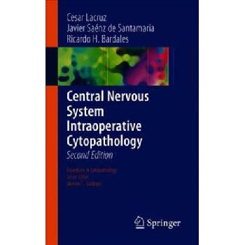 Central Nervous System Intraoperative Cytopathology | Cesar Lacruz, Javier Saénz de Santamaría, Ricardo H. Bardales
