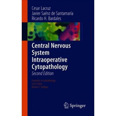 Central Nervous System Intraoperative Cytopathology | Cesar Lacruz, Javier Saénz de Santamaría, Ricardo H. Bardales