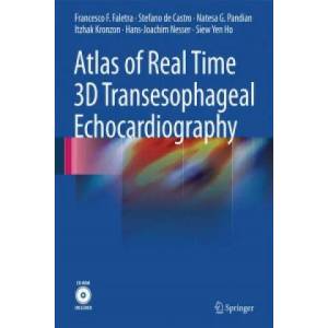 Atlas of Real Time 3D Transesophageal Echocardiography | Francesco Faletra (2010)