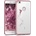 kwmobile Прозрачен калъф с дизайн фея за Huawei P9 Lite 2017 - розов