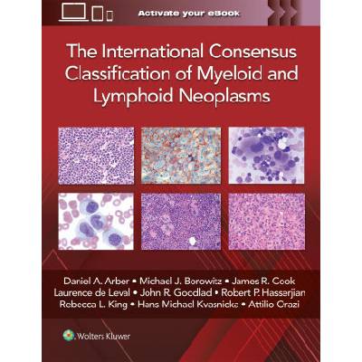 The International Consensus Classification of Myeloid and Lymphoid Neoplasms - Daniel A. Arber