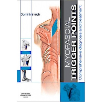 Myofascial Trigger Points