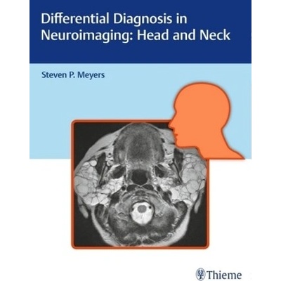 Differential Diagnosis in Neuroimaging