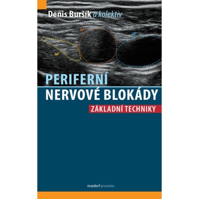 Periferní nervové blokády - Základní techniky | Denis Buršík