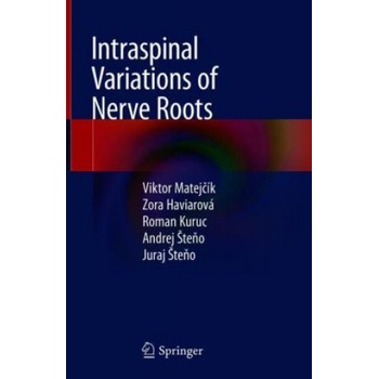 Intraspinal Variations of Nerve Roots | Viktor Matejcík, Zora Haviarová, Roman Kuruc, Andrej Steno, Juraj Steno