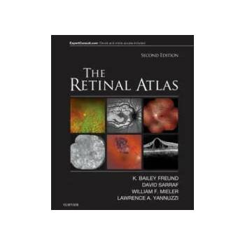 Image 1 of Retinal Atlas | K. Bailey Freund, David Sarraf, William F. Mieler, Lawrence A. Yannuzzi