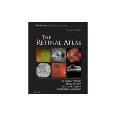 Retinal Atlas | K. Bailey Freund, David Sarraf, William F. Mieler, Lawrence A. Yannuzzi
