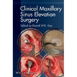 Clinical Maxillary Sinus Elevation Surgery | Daniel W. K. Kao (ISBN: 9780470960738)