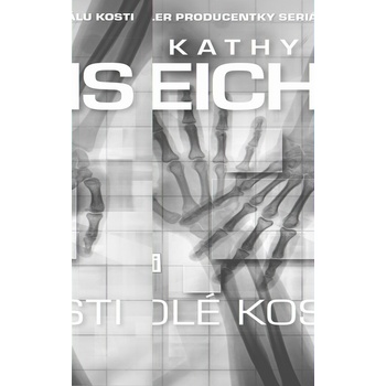 Holé kosti